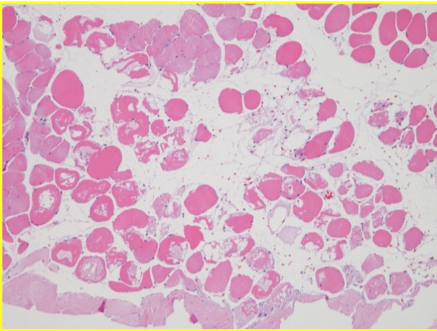 Endopeel'den 25 dakika sonra