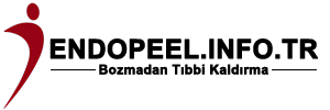 ENDOPEEL.INFO.TR
