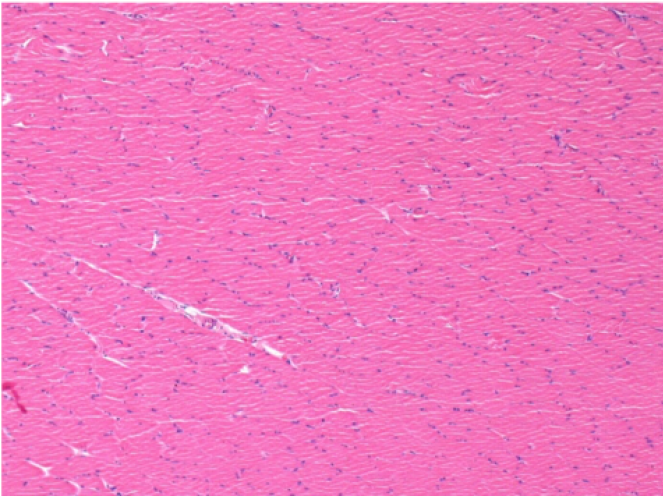 Sol Kontrol- 100xD30