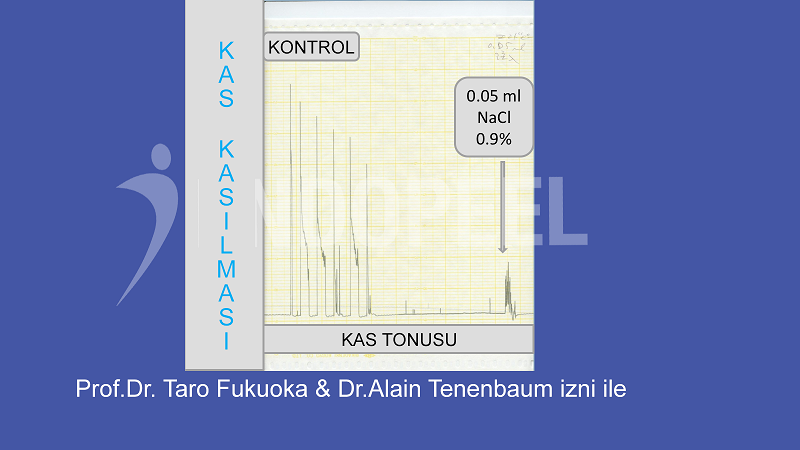 Kas Kasılması ve Kas Tonus Kontrolü